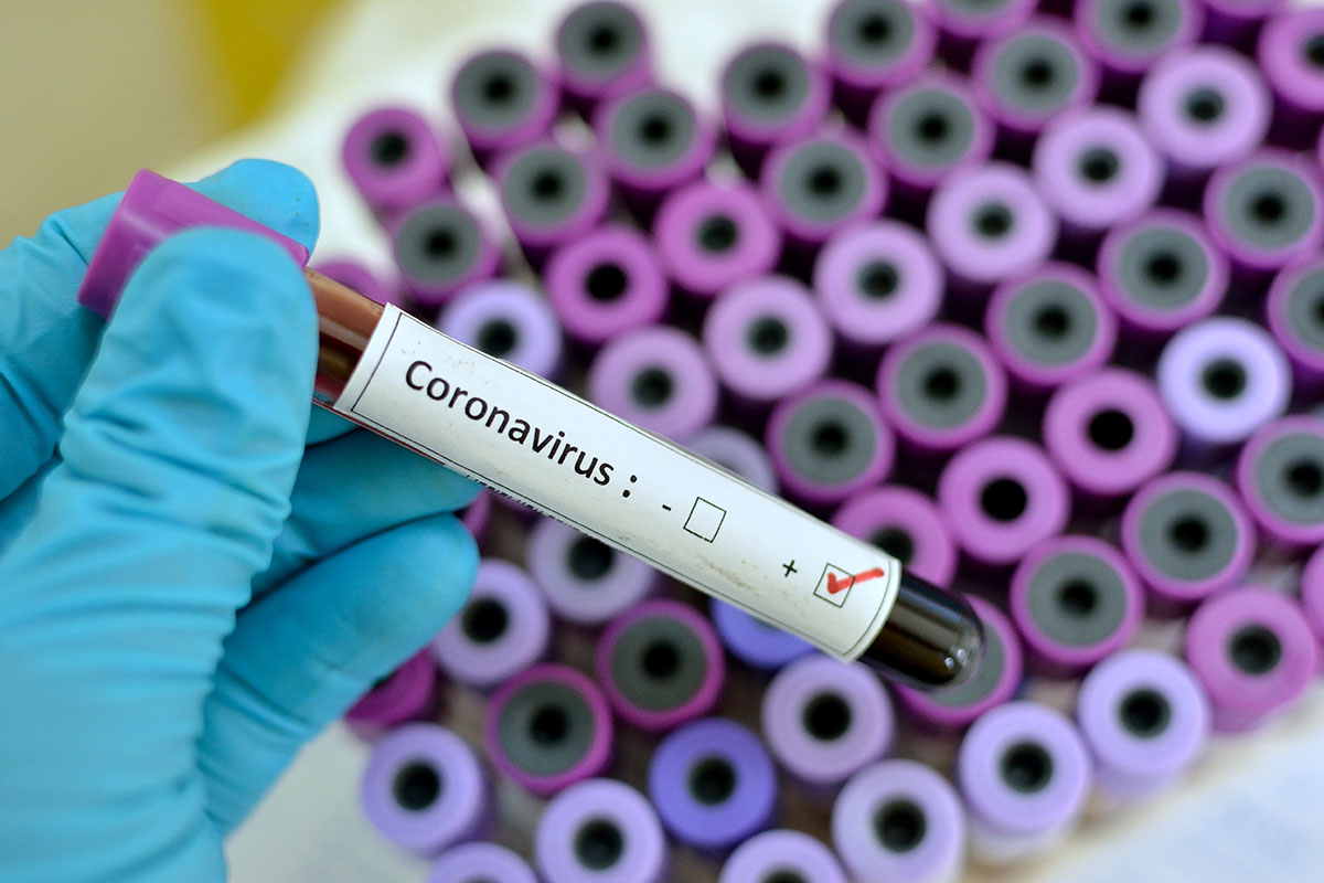 Coronavirus explained: Everything we know